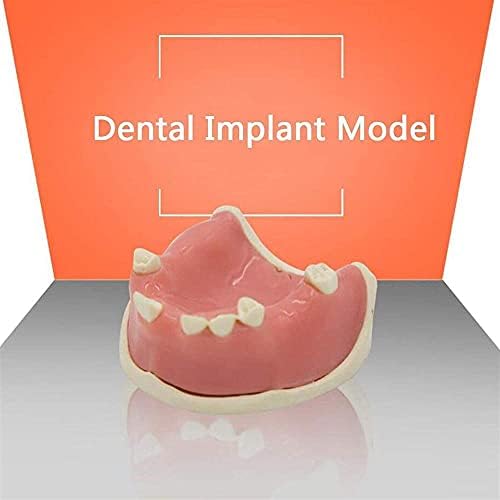 NAOSIN-NI Studijski model oralni zubi Model maksilaran Nedostajajući zubni implantat model sa mekim desnima zubne prakse medicinska obrazovna pomoć