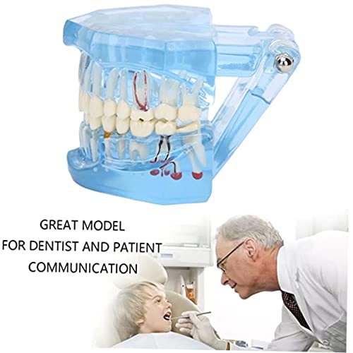 Dentalni anatomijski model - Transparentna demontažna demonstracija i simulacijski model za oralno obrazovanje Pomoć za zube i gumu
